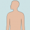 Welke lichamelijke kenmerken kun je hebben bij Klinefelter syndroom? thumbnail