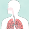 Thumbnail voor 'Wat is astma?'