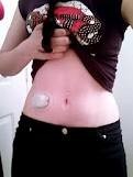 omnipod3
